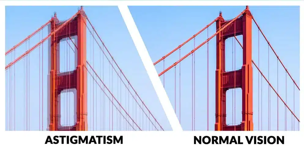 astigmatism_2.jpg Astigmatism in Monterey & Seaside, CA